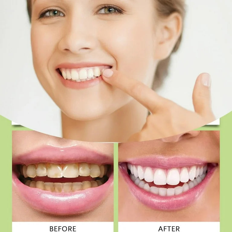 Remineralizing Chewing Gum – Mastic Mint | Nano-Hydroxyapatite, Sugar-Free